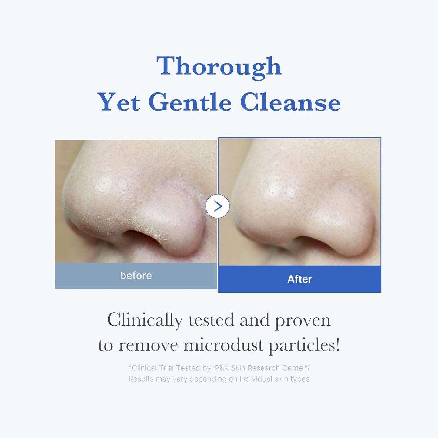Facial Cleanser Zero Foam Cleanser for Pore & Excess Oil Care | Daily Gentle Cleansing Foam - Excess Sebum Control, Hydration, Pore Minimization, Korean Skincare, Sensitive Skin, 4.23 Oz